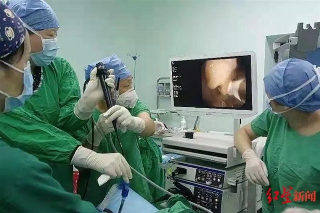 酥肉卡进阿姨气管险丢命 医生:小时候妈妈说的这句话很有医学道理