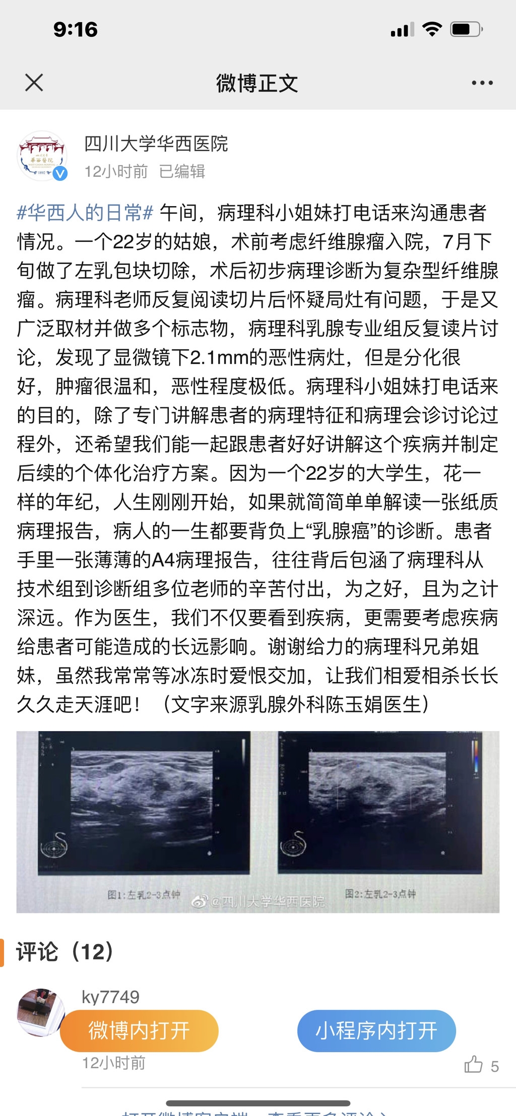 华西医院一份有温度的病理报告:我们不仅要看到疾病,更需要考虑疾病给