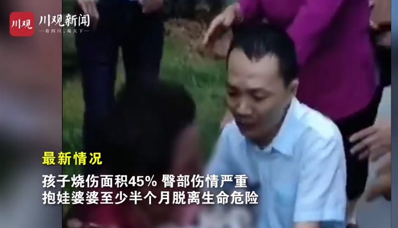 成都电瓶车爆燃事故追踪女婴已脱离生命危险不到2小时